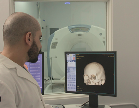 Imagen de una Tomografía Computada para observar la reconstrucción de un cráneo para la detección de fracturas posterior a un traumatismo cráneo encefálico