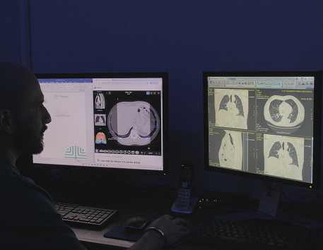 Tomografía computarizada de tórax de alta resolución donde se pueden detectar tumores, neumonías, nódulos, y enfermedades intersticiales pulmonares